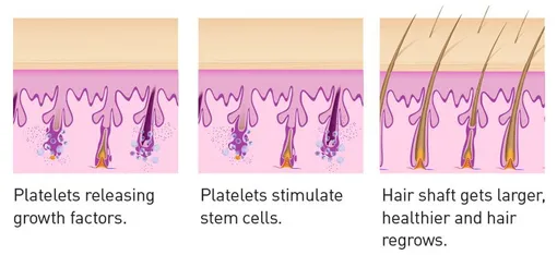 Hawaii Hair Restoration